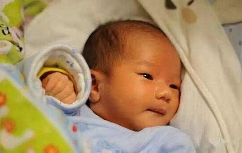 成人黄疸要手术吗视频,成人黄疸手术必要性解析