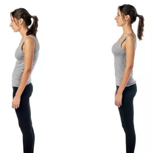 成人驼背体态矫正视频,跟随专业视频，重塑挺拔身姿