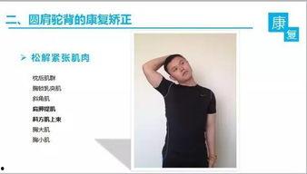 成人驼背体态矫正视频,跟随专业视频，重塑挺拔身姿