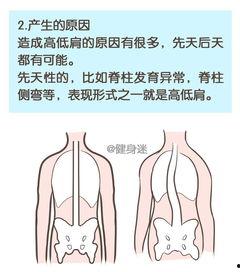 成人驼背体态矫正视频,跟随专业视频，重塑挺拔身姿